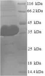 Recombinant Human Protein argonaute-2 (AGO2), partial – Figure 1 of 1