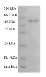 Recombinant Human A disintegrin and metalloproteinase with thrombospondin motifs 7 (ADAMTS7), partial – Figure 1 of 1