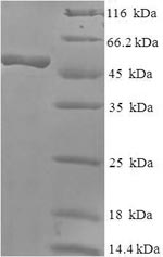 Recombinant Human Rab effector Noc2 (RPH3AL) – Figure 1 of 1