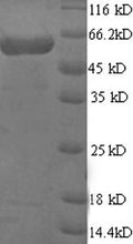 Recombinant Human Multiple inositol polyphosphate phosphatase 1 (MINPP1) – Figure 1 of 1