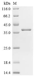 (Tris-Glycine gel) Discontinuous SDS-PAGE (reduced) with 5% enrichment gel and 15% separation gel.