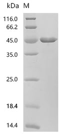 (Tris-Glycine gel) Discontinuous SDS-PAGE (reduced) with 5% enrichment gel and 15% separation gel.