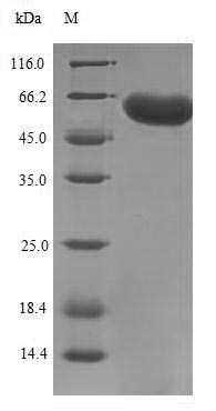 Recombinant Human F-box/LRR-repeat protein 2 (FBXL2) – Figure 1 of 1