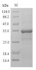 Recombinant Human Malignant T-cell-amplified sequence 1 (MCTS1) – Figure 1 of 1