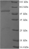 Recombinant Human Probable dimethyladenosine transferase (DIMT1) – Figure 1 of 1