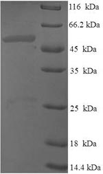 Recombinant Human Probable dimethyladenosine transferase (DIMT1) – Figure 1 of 1