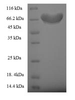 Recombinant Human Fizzy-related protein homolog (FZR1) – Figure 1 of 1