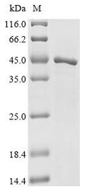 (Tris-Glycine gel) Discontinuous SDS-PAGE (reduced) with 5% enrichment gel and 15% separation gel.
