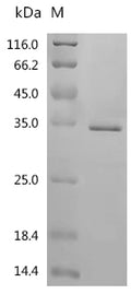 (Tris-Glycine gel) Discontinuous SDS-PAGE (reduced) with 5% enrichment gel and 15% separation gel.