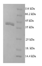 Recombinant Drosophila melanogaster Partner of bursicon (pburs) – Figure 1 of 1