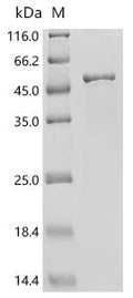 (Tris-Glycine gel) Discontinuous SDS-PAGE (reduced) with 5% enrichment gel and 15% separation gel.