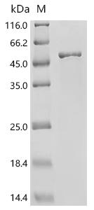 (Tris-Glycine gel) Discontinuous SDS-PAGE (reduced) with 5% enrichment gel and 15% separation gel.