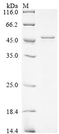(Tris-Glycine gel) Discontinuous SDS-PAGE (reduced) with 5% enrichment gel and 15% separation gel.