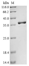 (Tris-Glycine gel) Discontinuous SDS-PAGE (reduced) with 5% enrichment gel and 15% separation gel.