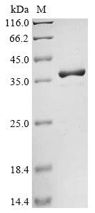(Tris-Glycine gel) Discontinuous SDS-PAGE (reduced) with 5% enrichment gel and 15% separation gel.