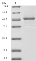 (Tris-Glycine gel) Discontinuous SDS-PAGE (reduced) with 5% enrichment gel and 15% separation gel.