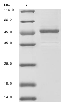 (Tris-Glycine gel) Discontinuous SDS-PAGE (reduced) with 5% enrichment gel and 15% separation gel.