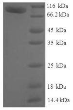 Recombinant Human Myotubularin-related protein 7 (MTMR7) – Figure 1 of 1