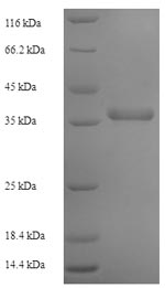 Recombinant Human DNA replication complex GINS protein PSF2 (GINS2) – Figure 1 of 1