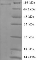 Recombinant Human Protein-arginine deiminase type-2 (PADI2) – Figure 1 of 1