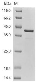 (Tris-Glycine gel) Discontinuous SDS-PAGE (reduced) with 5% enrichment gel and 15% separation gel.