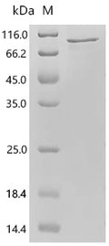 Recombinant Human Ubiquitin carboxyl-terminal hydrolase 15 (USP15), partial – Figure 1 of 1