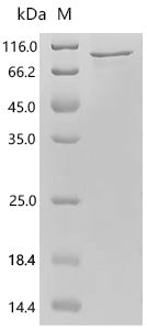 Recombinant Human Ubiquitin carboxyl-terminal hydrolase 15 (USP15), partial – Figure 1 of 1