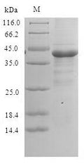 (Tris-Glycine gel) Discontinuous SDS-PAGE (reduced) with 5% enrichment gel and 15% separation gel.