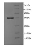 Recombinant Human Serine/threonine-protein phosphatase 2A regulatory subunit B'' subunit beta (PPP2R3B) – Figure 1 of 1