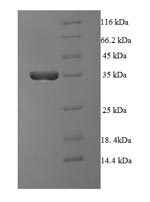 Recombinant Human Serine/threonine-protein phosphatase 2A regulatory subunit B'' subunit beta (PPP2R3B) – Figure 1 of 1
