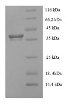 Recombinant Human Heme-binding protein 2 (HEBP2) – Figure 1 of 1