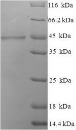 Recombinant Human Collectin-10 (COLEC10) – Figure 1 of 1