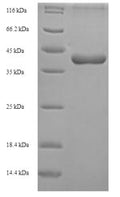 Recombinant Mouse CCN family member 5 (Ccn5) – Figure 1 of 1