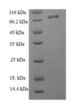 Recombinant Human Nucleolar protein 58 (NOP58) – Figure 1 of 1