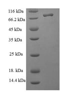Recombinant Human Nucleolar protein 58 (NOP58) – Figure 1 of 1