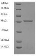 Recombinant Human 39S ribosomal protein L11, mitochondrial (MRPL11), partial – Figure 1 of 1