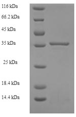 Recombinant Human 39S ribosomal protein L11, mitochondrial (MRPL11), partial – Figure 1 of 1