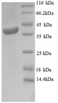 Recombinant Human Mitochondrial import inner membrane translocase subunit TIM16 (PAM16) – Figure 1 of 1