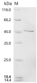 (Tris-Glycine gel) Discontinuous SDS-PAGE (reduced) with 5% enrichment gel and 15% separation gel.