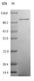 Recombinant Human Coiled-coil domain-containing protein 41 (CCDC41) – Figure 1 of 1
