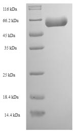 Recombinant Human Actin-like protein 7A (ACTL7A) – Figure 1 of 1