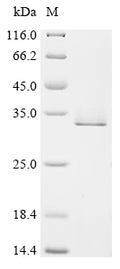 (Tris-Glycine gel) Discontinuous SDS-PAGE (reduced) with 5% enrichment gel and 15% separation gel.
