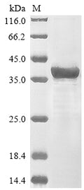 (Tris-Glycine gel) Discontinuous SDS-PAGE (reduced) with 5% enrichment gel and 15% separation gel.