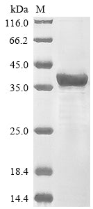 (Tris-Glycine gel) Discontinuous SDS-PAGE (reduced) with 5% enrichment gel and 15% separation gel.