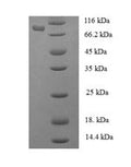 Recombinant Human Phenylalanine--tRNA ligase alpha subunit (FARSA) – Figure 1 of 1