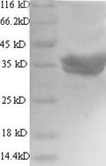 Recombinant Human Talin-2 (TLN2), partial – Figure 1 of 1