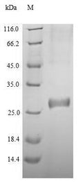Recombinant Human DNA (cytosine-5)-methyltransferase 3A(DNMT3A), partial – Figure 1 of 1