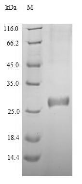 Recombinant Human DNA (cytosine-5)-methyltransferase 3A(DNMT3A), partial – Figure 1 of 1