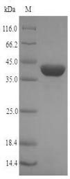 (Tris-Glycine gel) Discontinuous SDS-PAGE (reduced) with 5% enrichment gel and 15% separation gel.