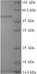 Recombinant Human Dehydrogenase/reductase SDR family member 7 (DHRS7) – Figure 1 of 1